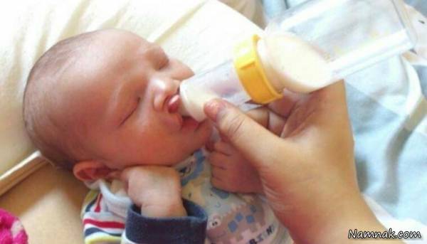 مشکلات تغذیه در نوزادان مبتلا به شکاف لب و کام شکاف لب و کام نوزادان