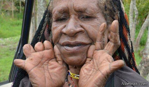 قطع کردن انگشت