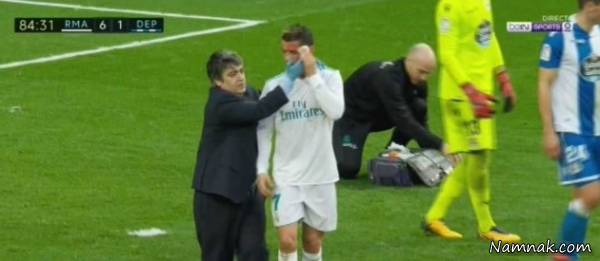 مصدومیت کریستیانو رونالدو 