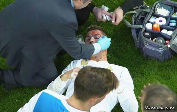 مصدومیت کریستیانو رونالدو