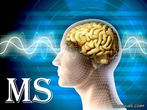 اختلال شخصیتی