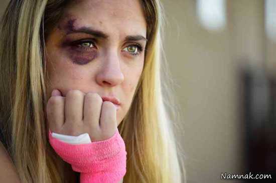 زن کتک خورده