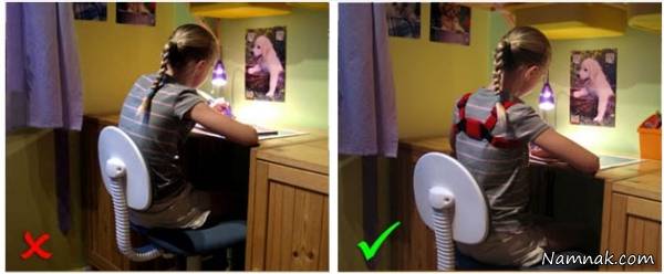 درمان قوز پشتی