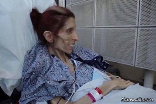 دختر 20 کیلویی 