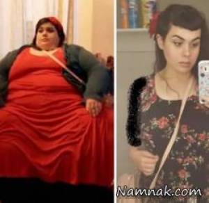 قبل و بعد کاهش وزن
