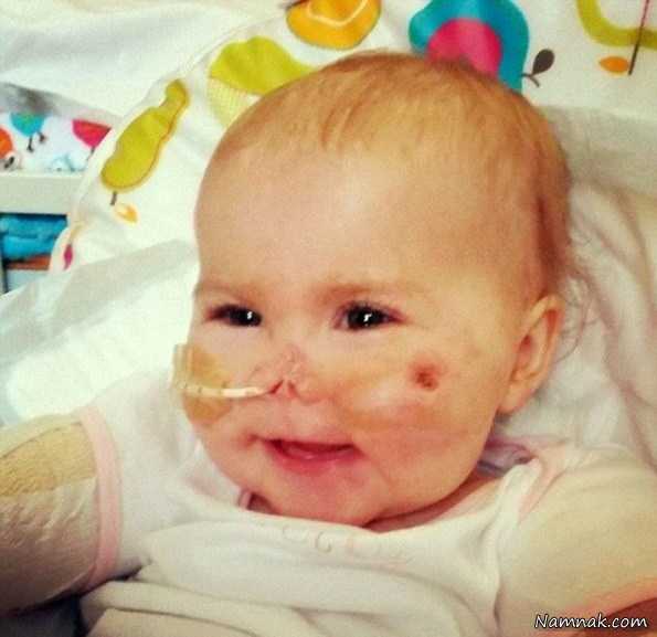 کودک بدون دست و پا