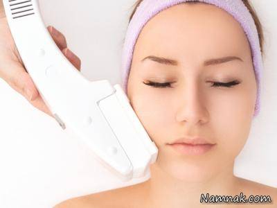 هیرسوتیسم در زنان