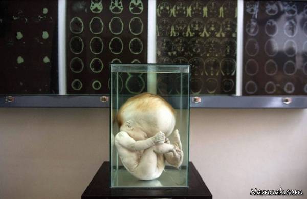 موزه ناهنجاری مغز