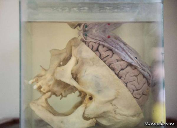 موزه ناهنجاری مغز