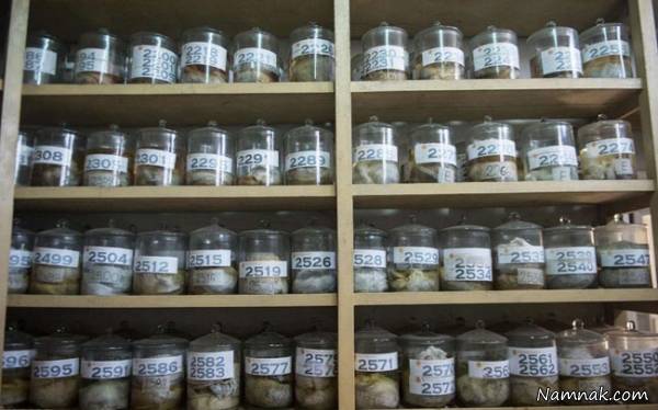 موزه ناهنجاری مغز