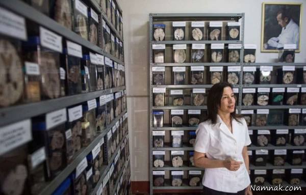 موزه ناهنجاری مغز