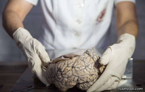 موزه ناهنجاری مغز