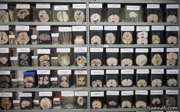 موزه ناهنجاری مغز