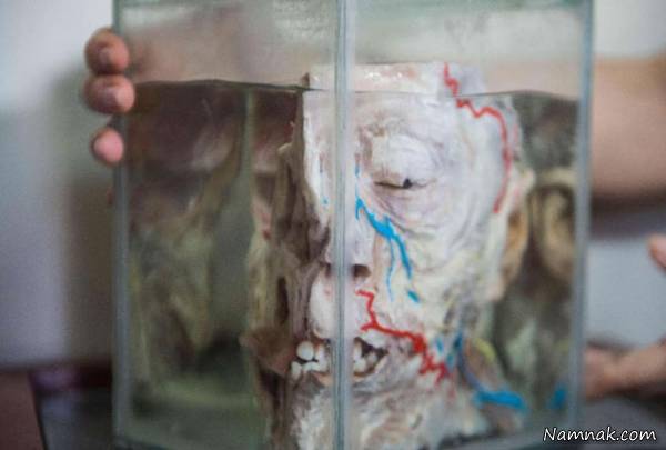 موزه ناهنجاری مغز 