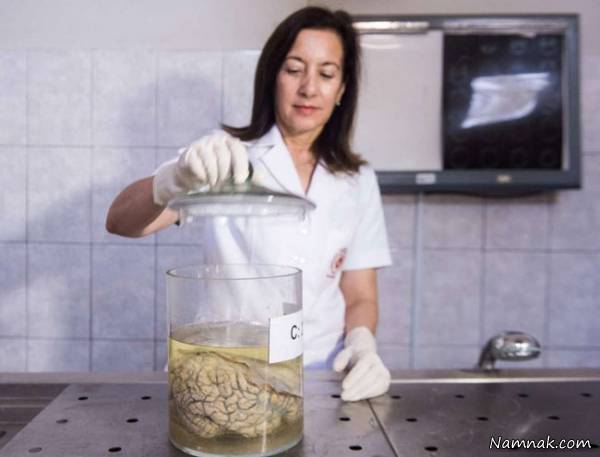 موزه ناهنجاری مغز