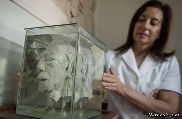 موزه ناهنجاری مغز