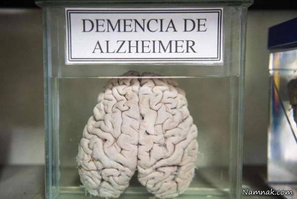 موزه ناهنجاری مغز