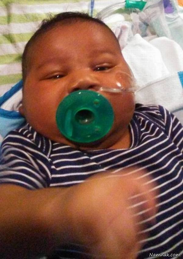 نوزاد غول پیکر