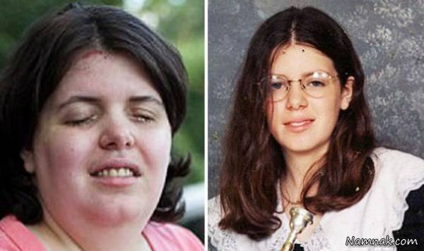 اختلال عجیب زن کور