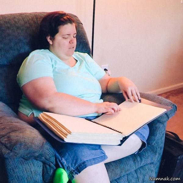 اختلال عجیب زن کور