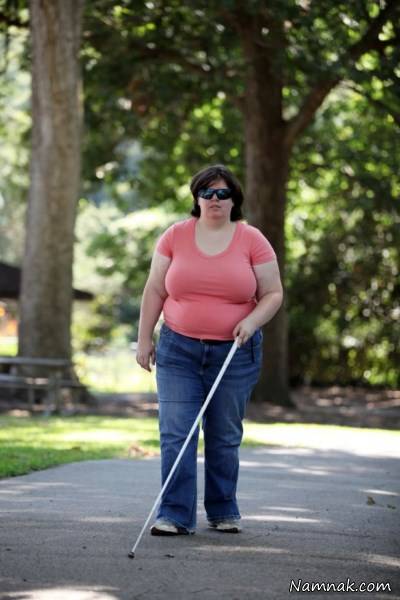 اختلال عجیب زن کور