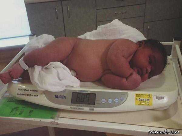 نوزاد غول پیکر