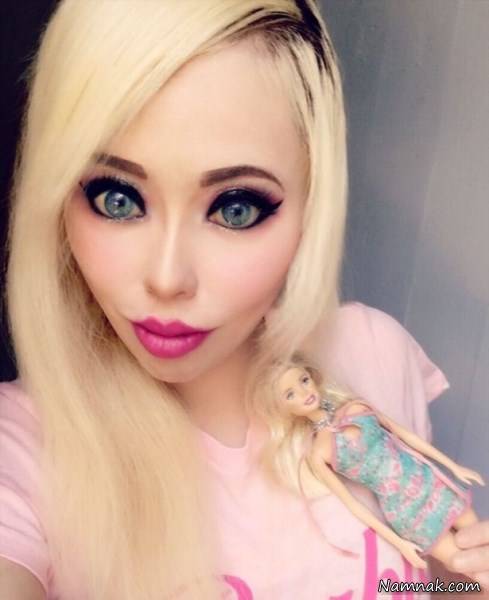 جراحی باربی