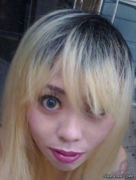 جراحی باربی