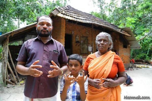 انگشتان چسبیده