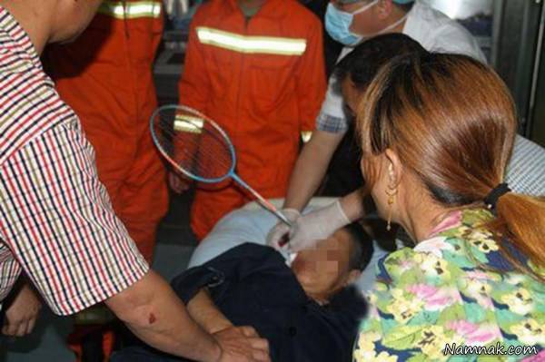 فرورفتن راکت داخل جمجمه 