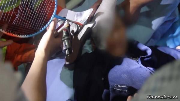 فرورفتن راکت داخل جمجمه 