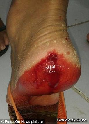 حمله پیرانا