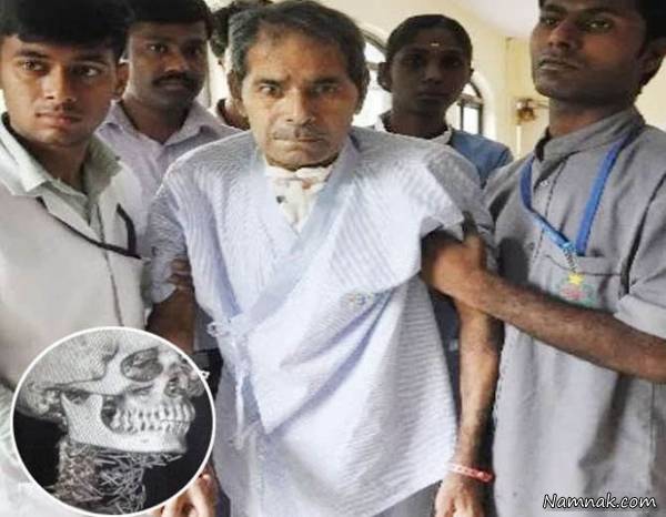 جراحی سوزن بدن سوزن بدن