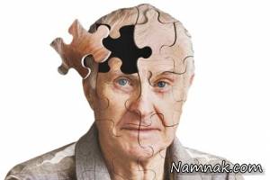 ژن آلزایمر