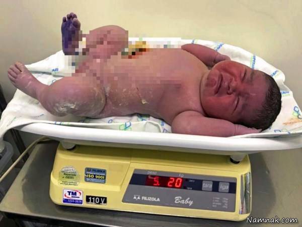 تولد نوزاد بزرگ در برزیل تولد نوزاد بزرگ
