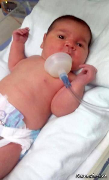 تولد نوزاد بزرگ و خیلی چاق تولد نوزاد بزرگ