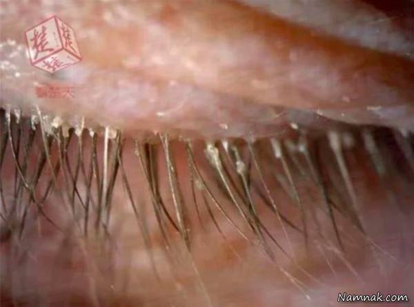 کرم مژه زن چینی کرم مژه