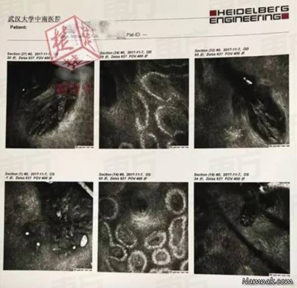 کرم مژه مرد چینی کرم مژه