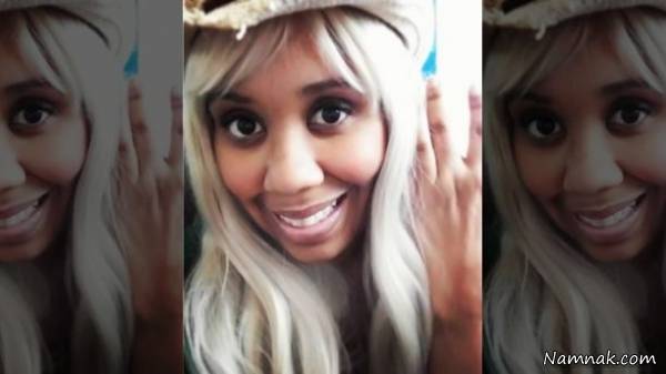 تغییر لهجه براثر سردرد تغییر لهجه