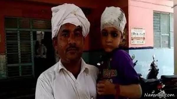 جراحی کودک هندی جراحی کودک