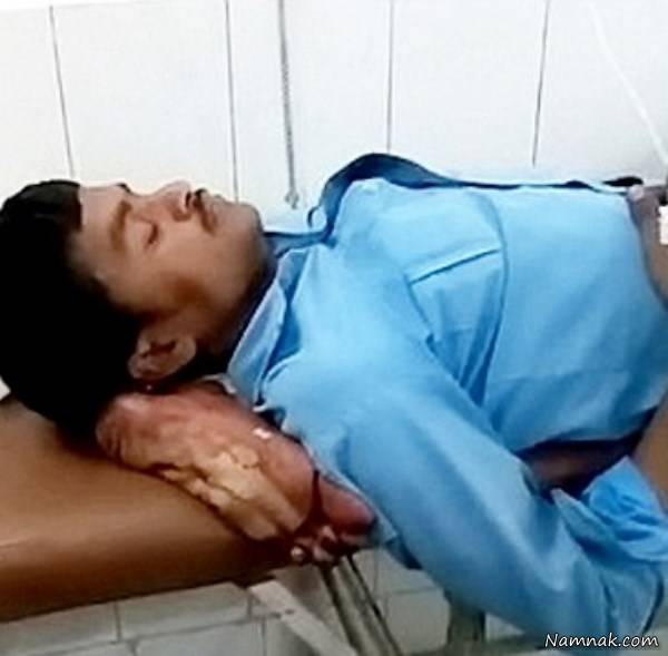 پای قطع شده