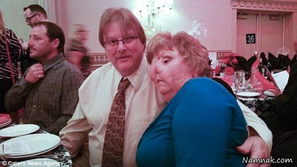 زن بدون بینی