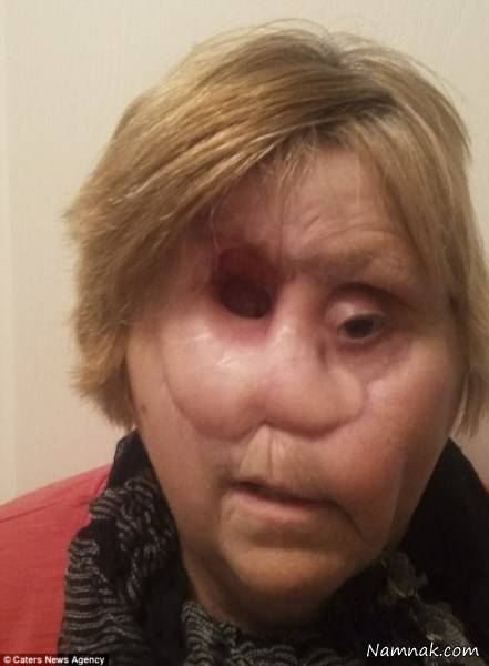 زن بدون بینی