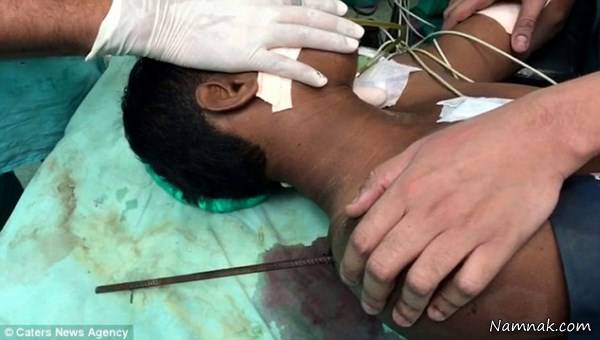 فرو رفتن میلگرد در گردن کارگر فرو رفتن میلگرد در گردن کارگر