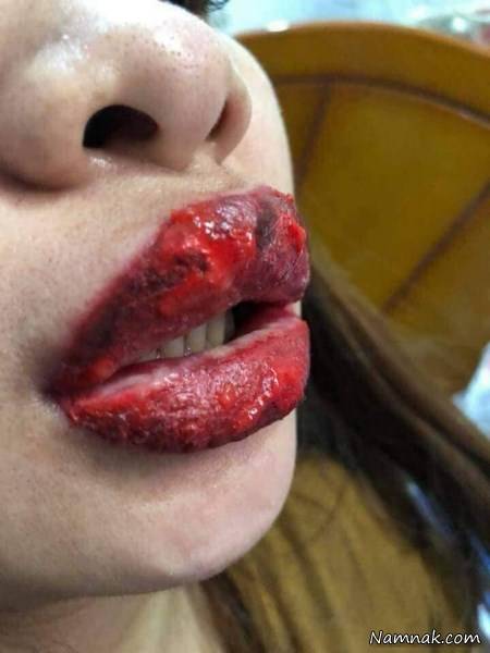 بلای رژلب تقلبی رژلب تقلبی