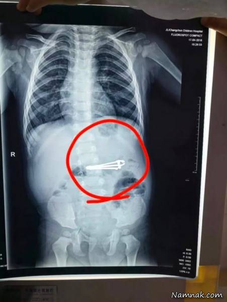 قورت دادن ناخن گیر