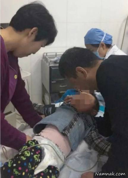 قورت دادن ناخن گیر