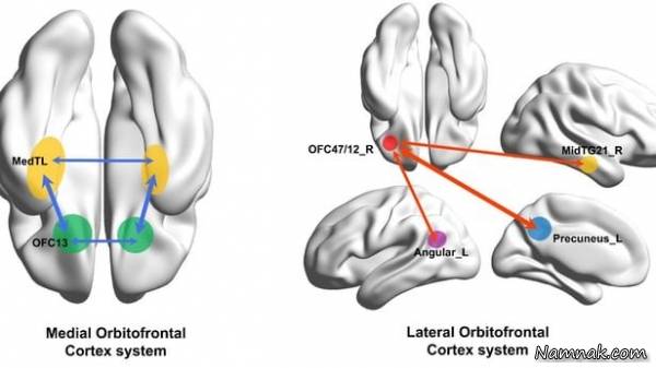 افسردگی مغز
