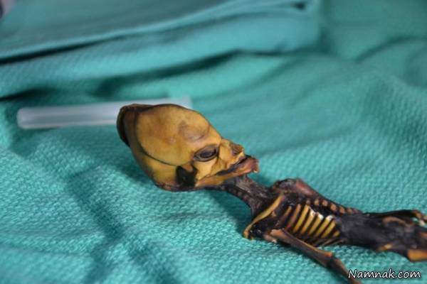 آدم کوچولوها 